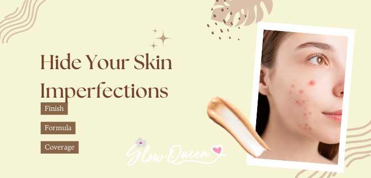 Five Best Foundations to Cover Up Your Acne