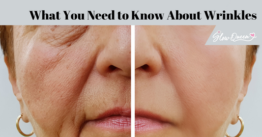 What You Need to Know About Wrinkles